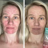 5 in 1 Anti-Redness Day Cream SPF50 – 30 ml