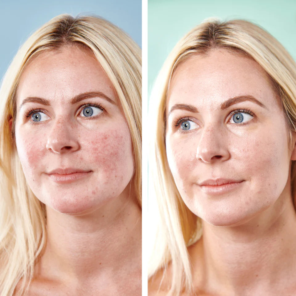 5 in 1 Anti-Redness Day Cream SPF50 – 30 ml